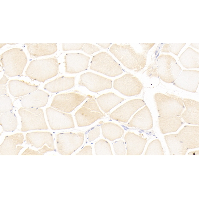 Leukemia Inhibitory Factor (LIF) Human Monoclonal Antibody