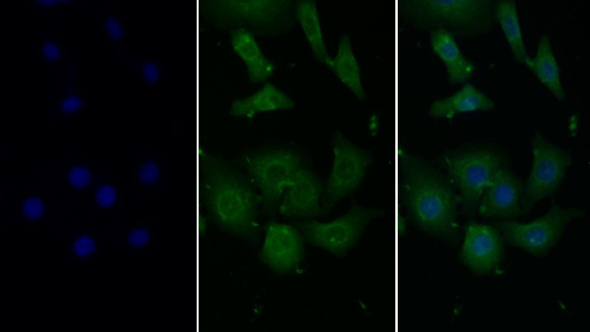 Monocyte Chemotactic Protein 1 (MCP1) Rabbit Monoclonal Antibody