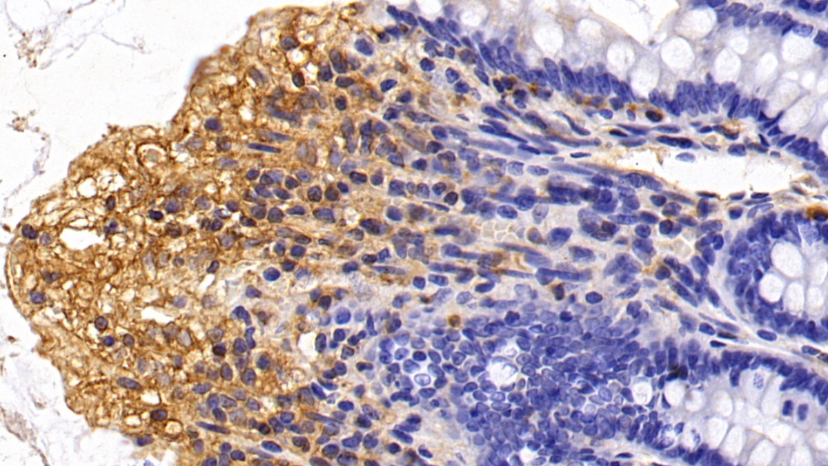 Macrophage Inflammatory Protein 1 Alpha (MIP1a) Rat Monoclonal Antibody
