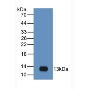 Macrophage Inflammatory Protein 3 Alpha (MIP3a) Human Monoclonal Antibody