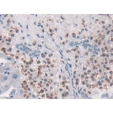 Macrophage Inflammatory Protein 3 Alpha (MIP3a) Human Monoclonal Antibody