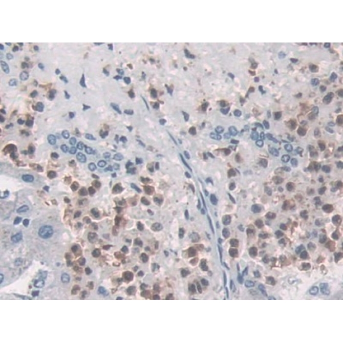 Macrophage Inflammatory Protein 3 Alpha (MIP3a) Human Monoclonal Antibody