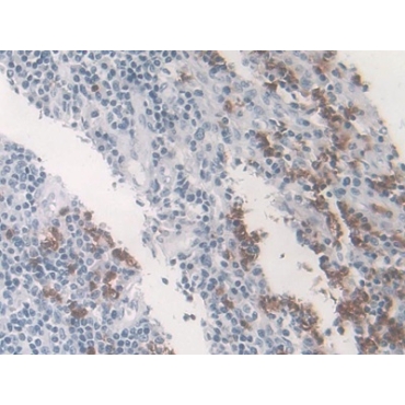 Macrophage Inflammatory Protein 3 Alpha (MIP3a) Human Monoclonal Antibody