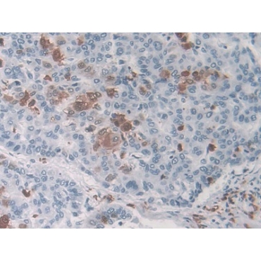 Macrophage Inflammatory Protein 3 Alpha (MIP3a) Human Monoclonal Antibody