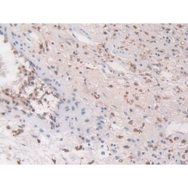Macrophage Inflammatory Protein 3 Alpha (MIP3a) Human Monoclonal Antibody