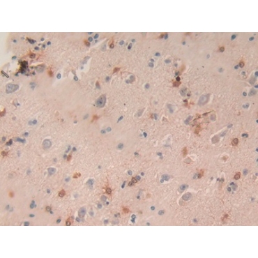 Macrophage Inflammatory Protein 3 Alpha (MIP3a) Human Monoclonal Antibody