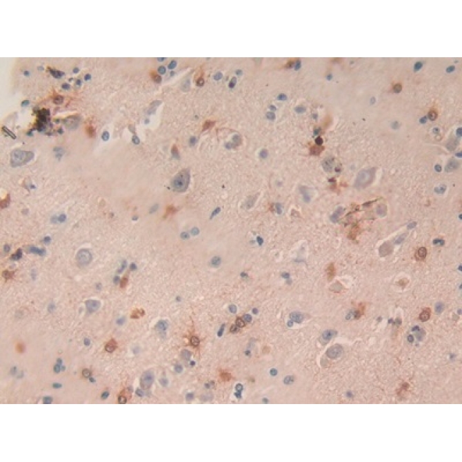 Macrophage Inflammatory Protein 3 Alpha (MIP3a) Human Monoclonal Antibody