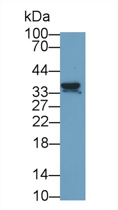 Nerve Growth Factor (NGF) Rat Monoclonal Antibody