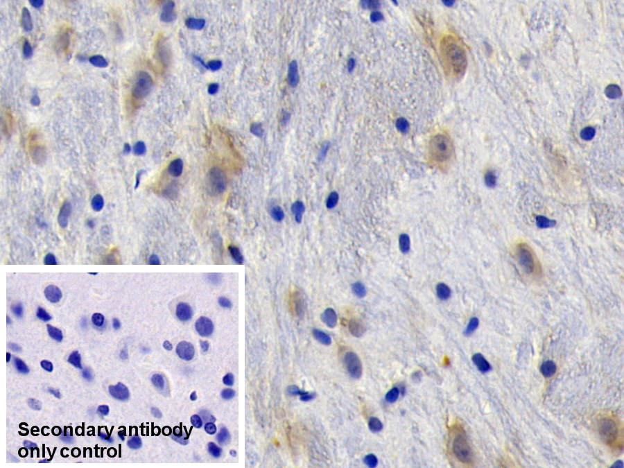 Nerve Growth Factor (NGF) Rat Monoclonal Antibody