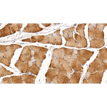 Creatine Kinase, Muscle (CKM) Human Monoclonal Antibody