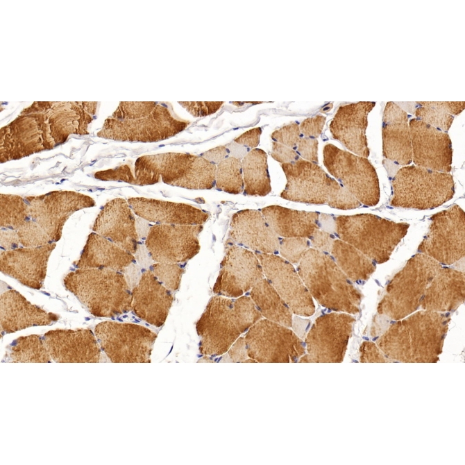 Creatine Kinase, Muscle (CKM) Human Monoclonal Antibody