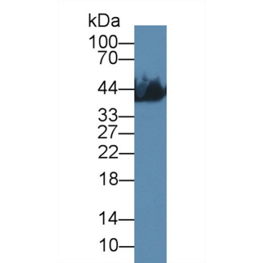 Creatine Kinase, Muscle (CKM) Human Monoclonal Antibody