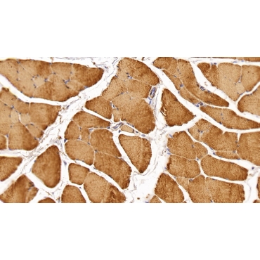 Creatine Kinase, Muscle (CKM) Human Monoclonal Antibody