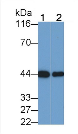 Creatine Kinase, Muscle (CKM) Human Monoclonal Antibody