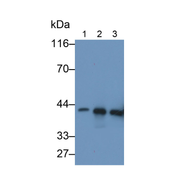 Creatine Kinase, Muscle (CKM) Human Monoclonal Antibody