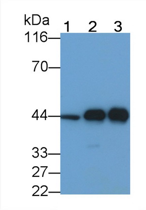 Creatine Kinase, Muscle (CKM) Human Monoclonal Antibody