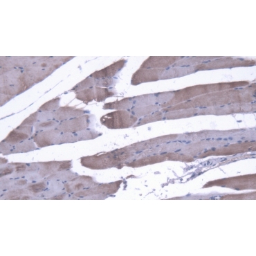 Creatine Kinase, Muscle (CKM) Mouse Monoclonal Antibody