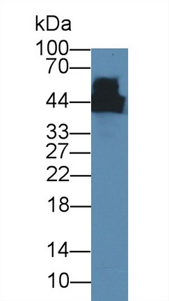 Creatine Kinase, Muscle (CKM) Rat Monoclonal Antibody