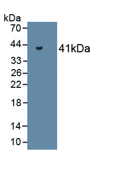 Creatine Kinase, Muscle (CKM) Rabbit Monoclonal Antibody