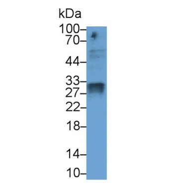 Superoxide Dismutase 3, Extracellular (SOD3) Human Monoclonal Antibody