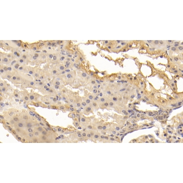 Superoxide Dismutase 3, Extracellular (SOD3) Human Monoclonal Antibody