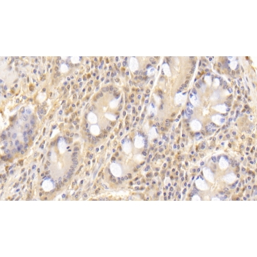 Superoxide Dismutase 3, Extracellular (SOD3) Human Monoclonal Antibody