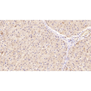 Superoxide Dismutase 3, Extracellular (SOD3) Human Monoclonal Antibody