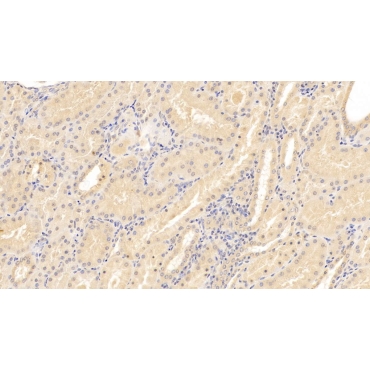 Cluster Of Differentiation 40 Ligand (CD40L) Human Monoclonal Antibody
