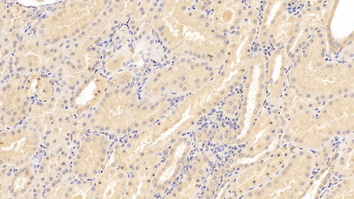Cluster Of Differentiation 40 Ligand (CD40L) Human Monoclonal Antibody