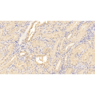 Cluster Of Differentiation 40 Ligand (CD40L) Human Monoclonal Antibody