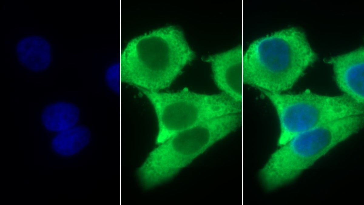 Stem Cell Factor Receptor (SCFR) Human Monoclonal Antibody