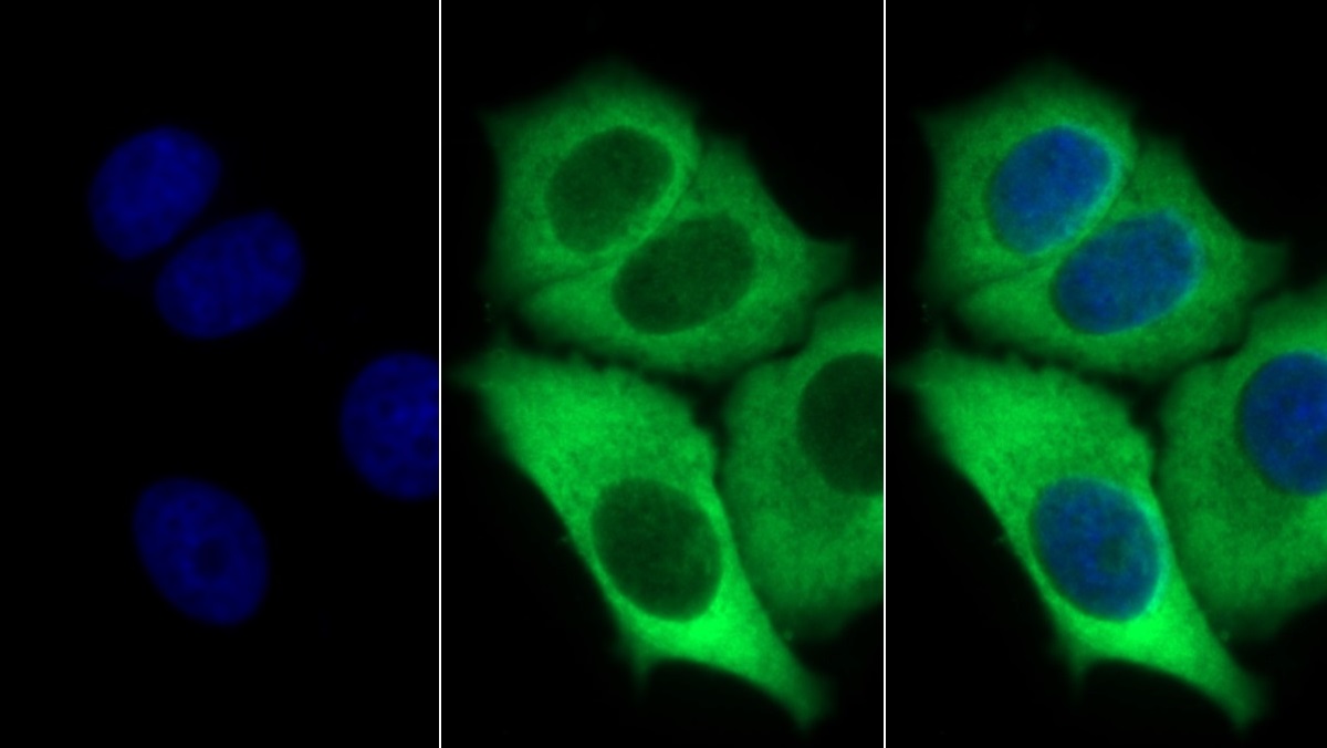 Stem Cell Factor Receptor (SCFR) Human Monoclonal Antibody