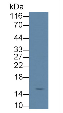 Transforming Growth Factor Alpha (TGFa) Human Monoclonal Antibody