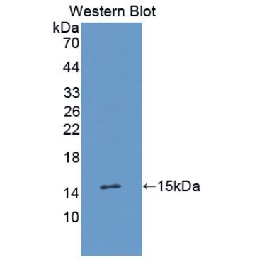 Transforming Growth Factor Alpha (TGFa) Human Monoclonal Antibody