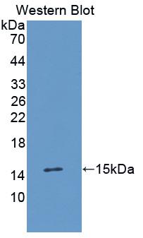 Transforming Growth Factor Alpha (TGFa) Human Monoclonal Antibody