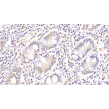 Transforming Growth Factor Alpha (TGFa) Human Monoclonal Antibody