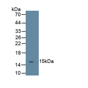 Transforming Growth Factor Beta 1 (TGFb1) Human Monoclonal Antibody