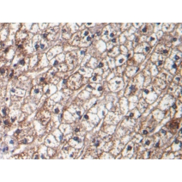 Transforming Growth Factor Beta 1 (TGFb1) Human Monoclonal Antibody