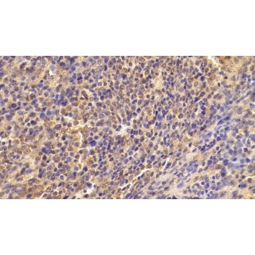 Transforming Growth Factor Beta 1 (TGFb1) Human Monoclonal Antibody