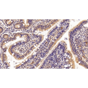 Transforming Growth Factor Beta 1 (TGFb1) Human Monoclonal Antibody