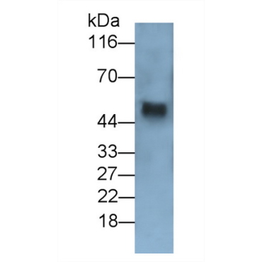 Transforming Growth Factor Beta 1 (TGFb1) Human Monoclonal Antibody
