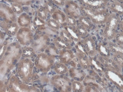 Transforming Growth Factor Beta 1 (TGFb1) Rat Monoclonal Antibody