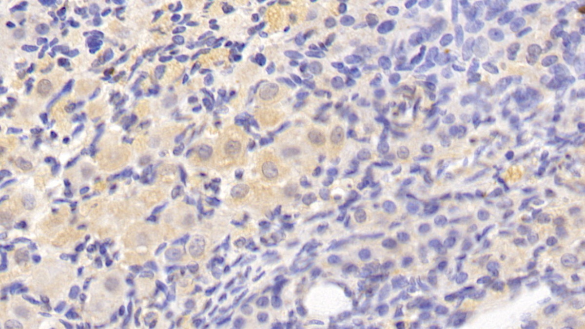 Transforming Growth Factor Beta 1 (TGFb1) Rat Monoclonal Antibody