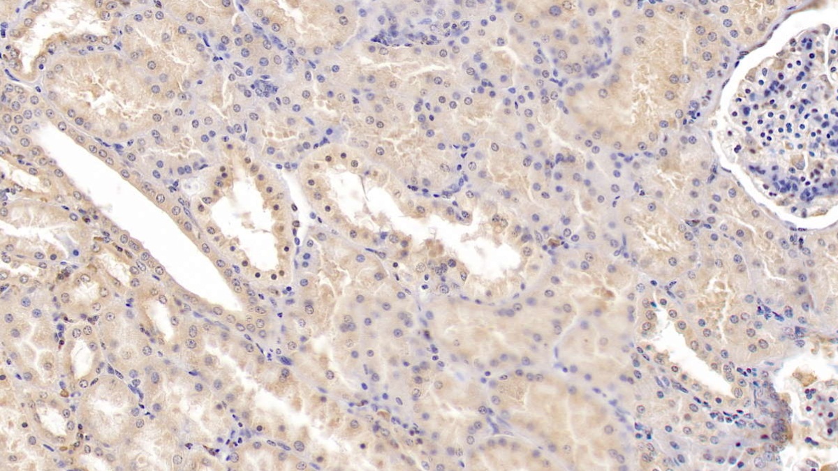 Tyrosine Kinase With Immunoglobulin Like And EGF Like Domains Protein 1 (Tie1) Human Monoclonal Antibody