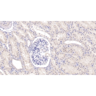 Tyrosine Kinase With Immunoglobulin Like And EGF Like Domains Protein 1 (Tie1) Human Monoclonal Antibody