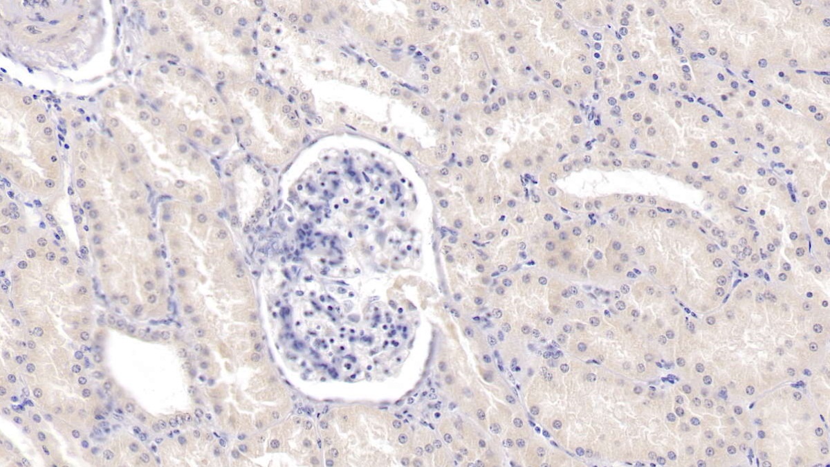 Tyrosine Kinase With Immunoglobulin Like And EGF Like Domains Protein 1 (Tie1) Human Monoclonal Antibody