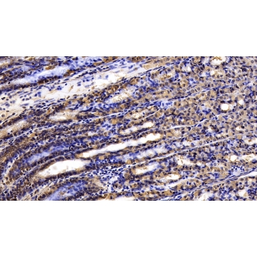Tissue Inhibitors Of Metalloproteinase 3 (TIMP3) Human Monoclonal Antibody