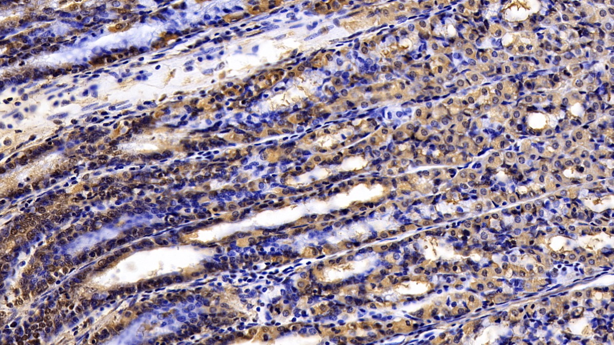 Tissue Inhibitors Of Metalloproteinase 3 (TIMP3) Human Monoclonal Antibody