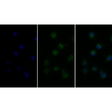 Tumor Necrosis Factor Alpha (TNFa) Human Monoclonal Antibody