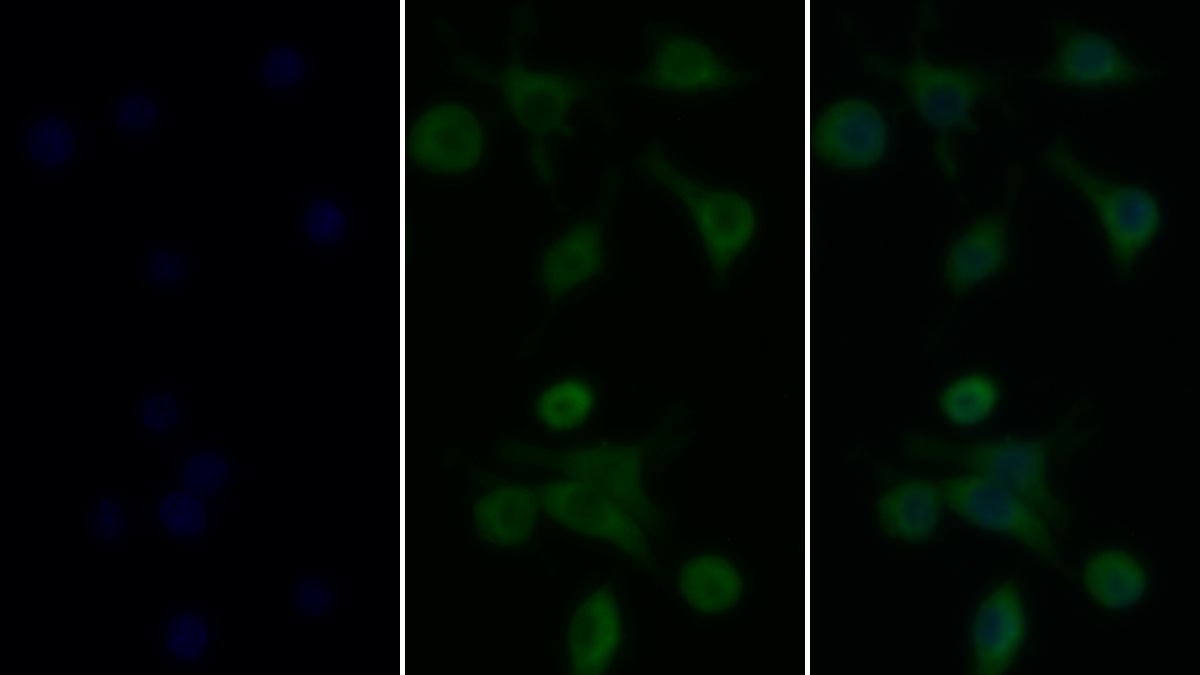 Tumor Necrosis Factor Alpha (TNFa) Rat Monoclonal Antibody